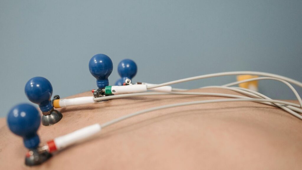SOP perekaman EKG